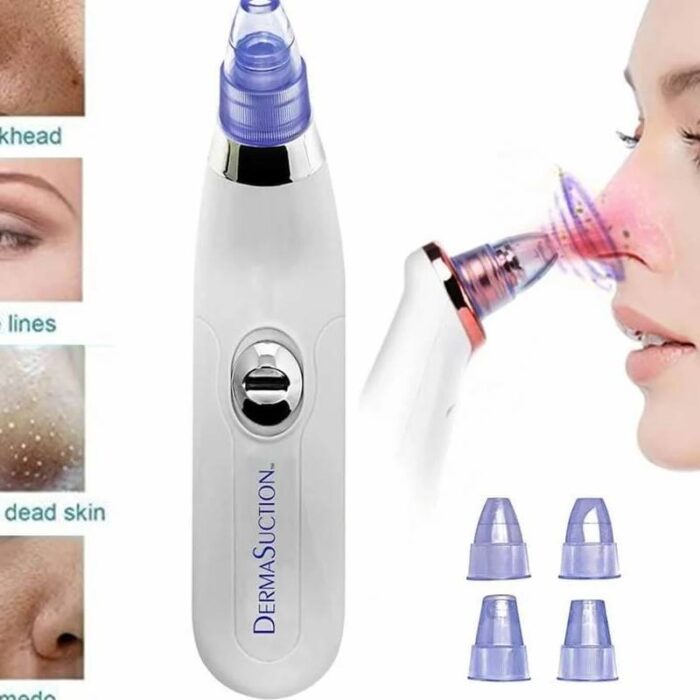 Blackhead remover